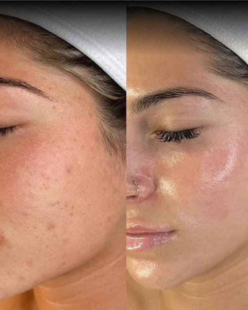 Dermalyn Labs™ Regenerative Skincare, Delivered Where It Matters