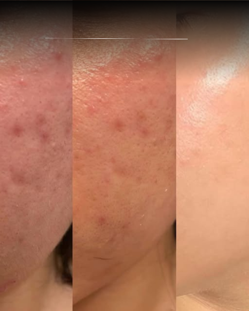 Dermalyn Labs™ Regenerative Skincare, Delivered Where It Matters