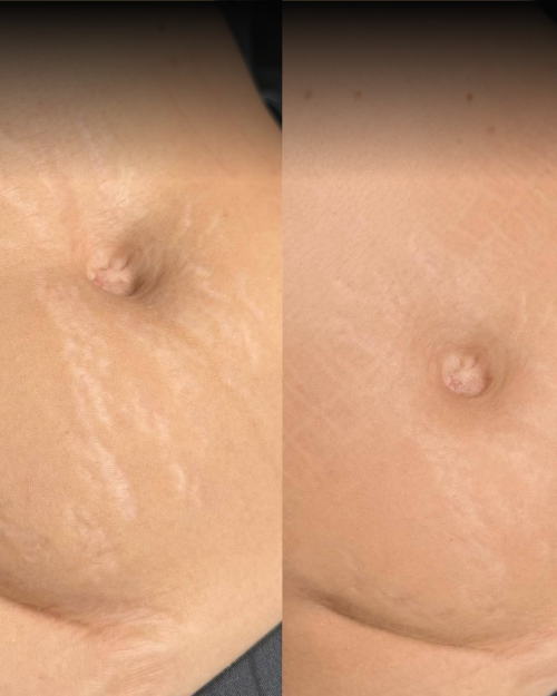 Dermalyn Labs™ Regenerative Skincare, Delivered Where It Matters