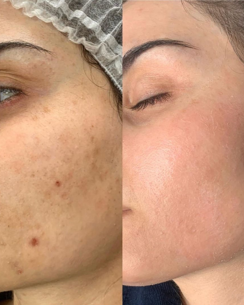 Dermalyn Labs™ Regenerative Skincare, Delivered Where It Matters