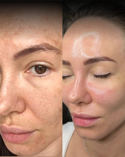Dermalyn Labs™ Regenerative Skincare, Delivered Where It Matters