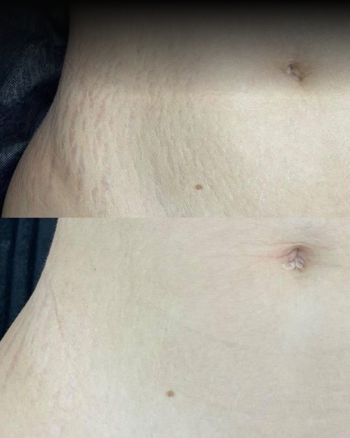 Dermalyn Labs™ Regenerative Skincare, Delivered Where It Matters